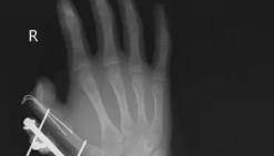 网购收到这东西,千万要当心!会爆炸会“放毒”!已有人受害