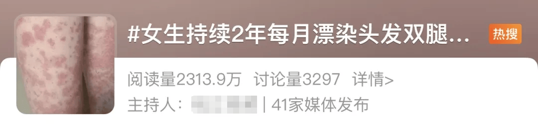 女生每月漂染头发，全身长满紫斑！这些美发方式可能会致癌！