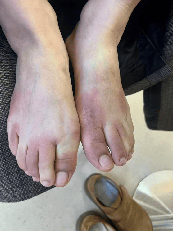 东北姑娘来浙江后崩溃了，穿3条加绒裤还冻到发抖！南方人冬天怎么保命，网友吵翻！